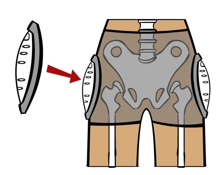 Hip protectors - Fraser Health Authority