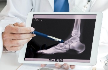 doctor holding  a tablet and discussing an x-ray